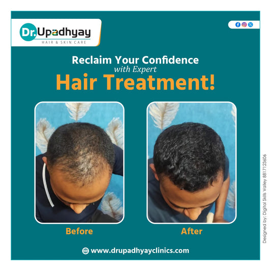 "Do your products actually help with hair fall and baldness?