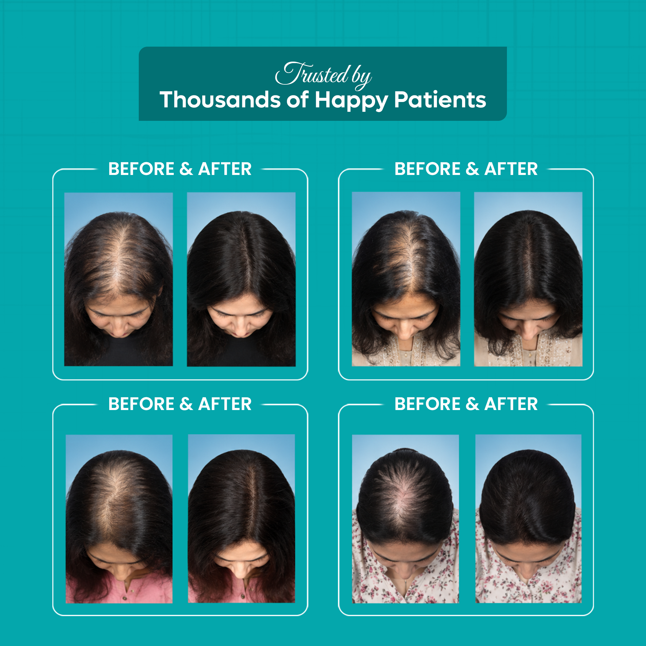 Female Hair Treatment  Kit