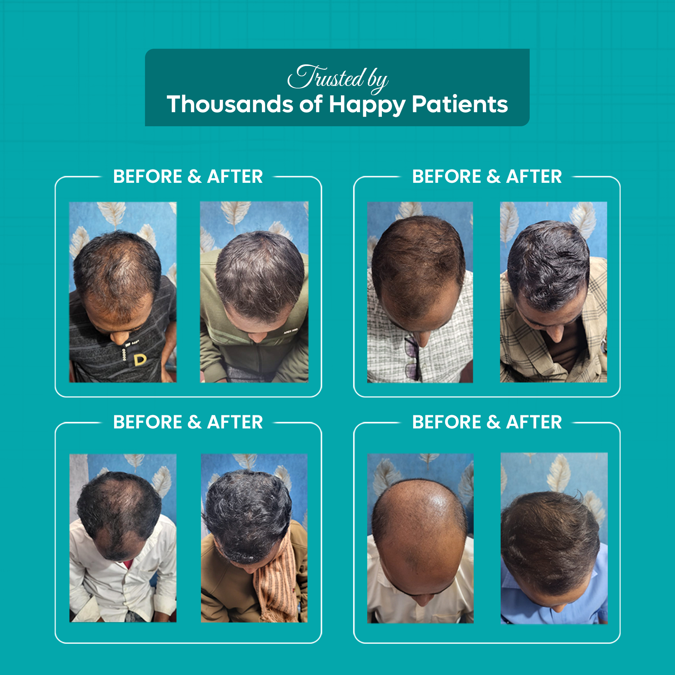 Male Hair Treatment Kit