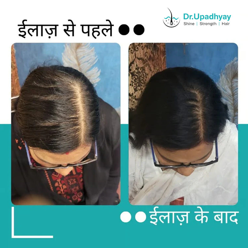 before after