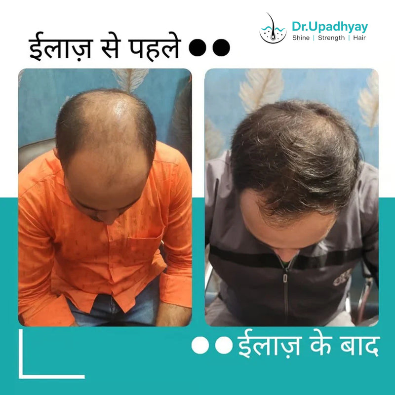 before after