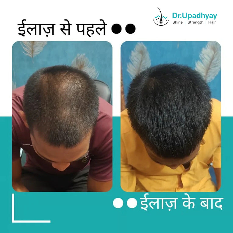 before after