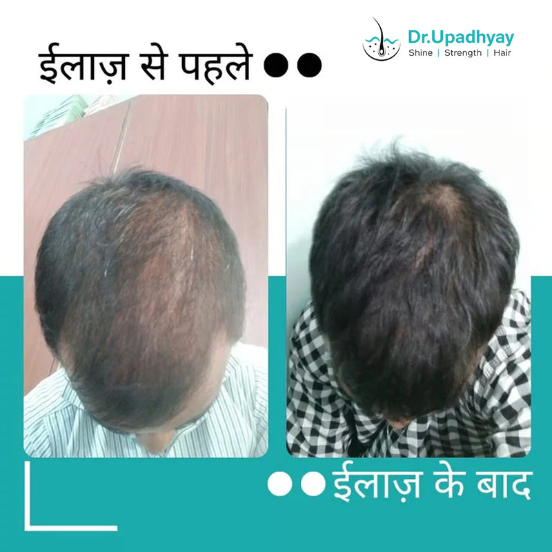 before after