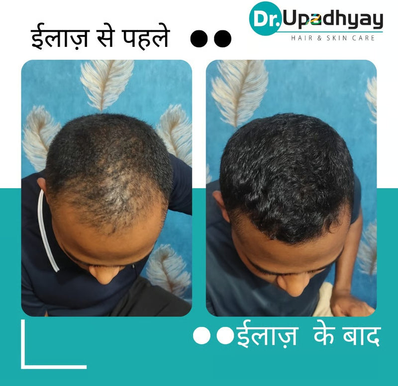 before after