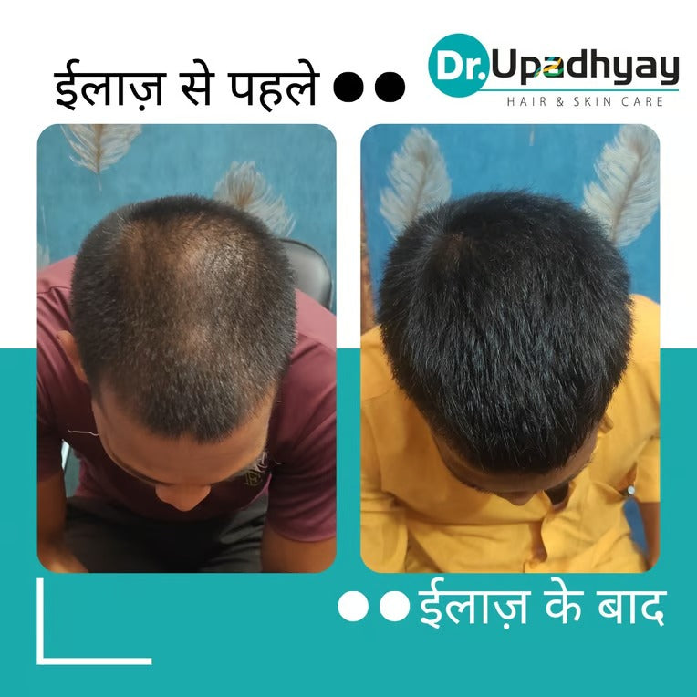 before after