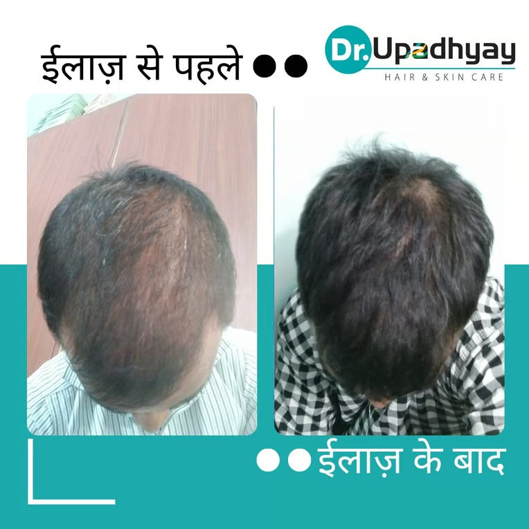 before after