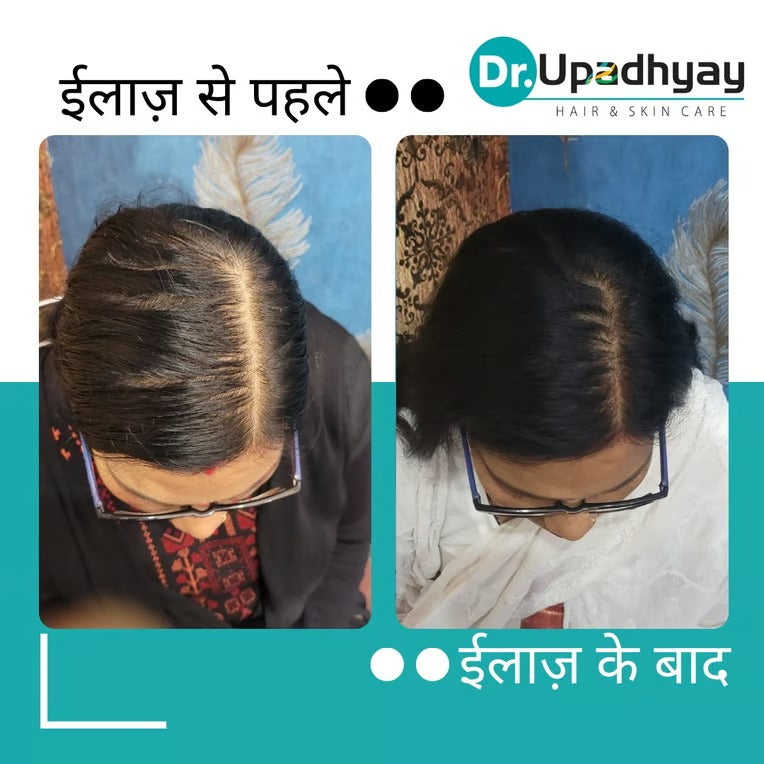 before after