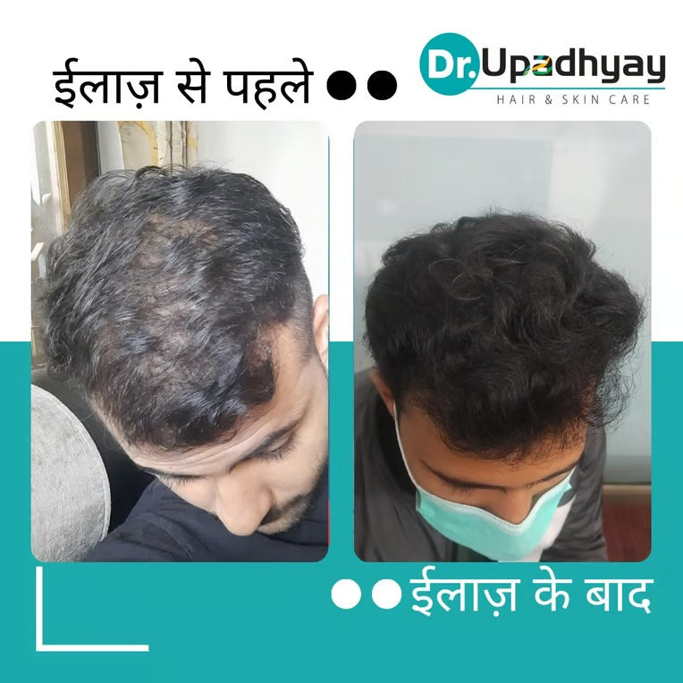 before after