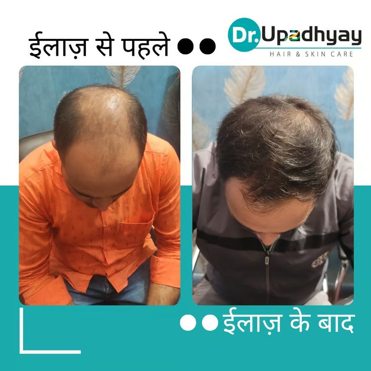 before after