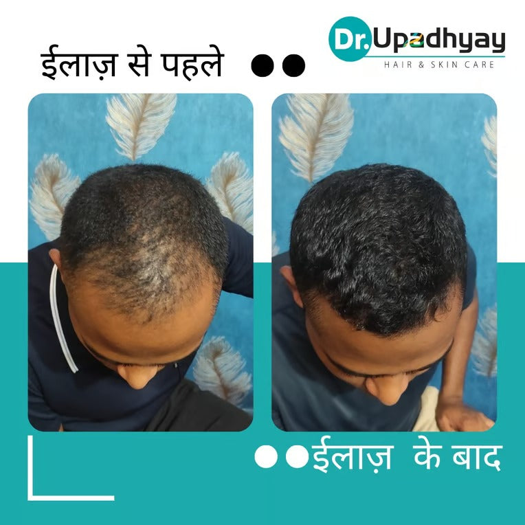 before after