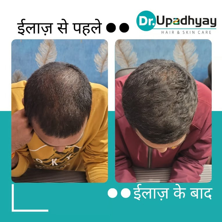 before after